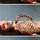 Illustration for article titled CMUs Robotic Arm Helps Medics Assist Wounded Soldiers Without Being in the Line of Fire